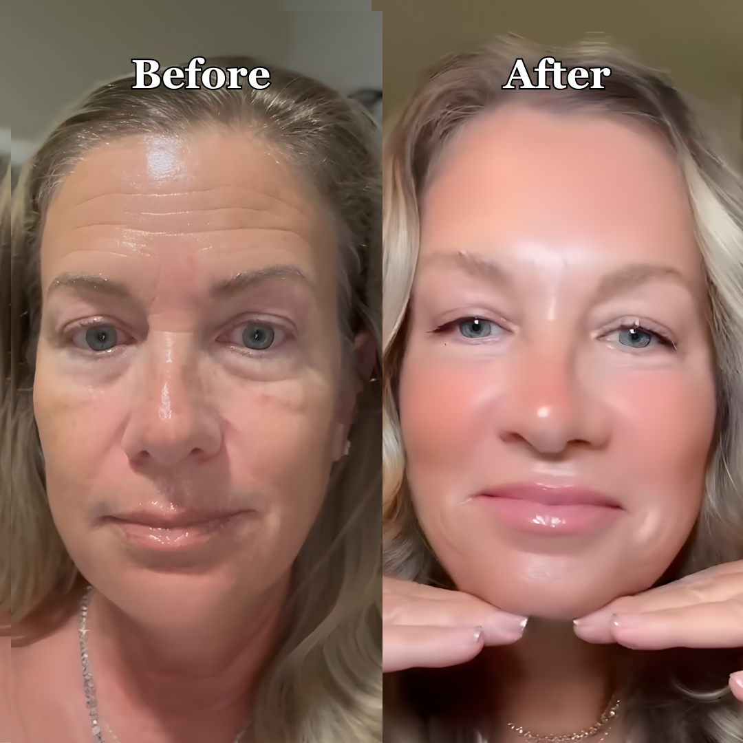 Side-by-side comparison of a woman's face before and after treatment.