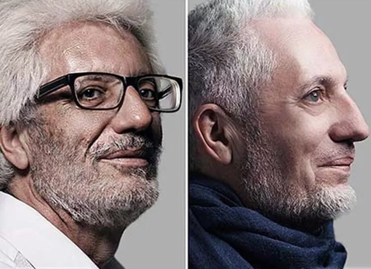 Antes y después - resultado 1