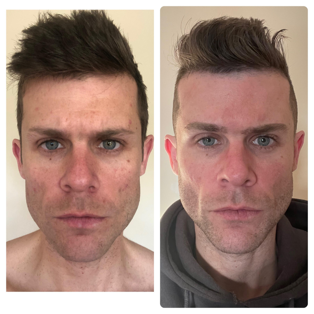 Antes y después - resultado 4