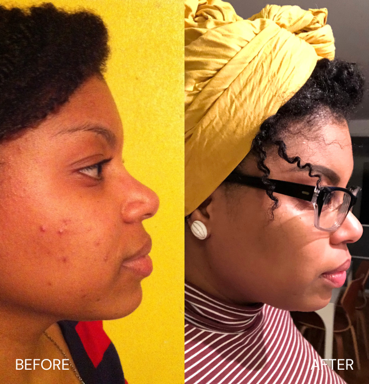Side-by-side before and after profile photos of a person with different hairstyles.