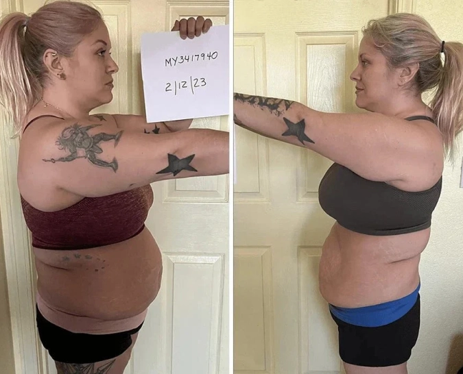 A before and after image showing a woman's weight loss transformation.
