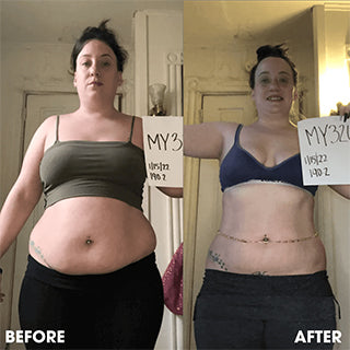 Side-by-side before and after photos of a woman showing weight loss progress.
