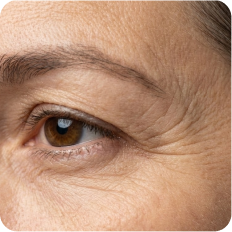 A close-up of a person's brown eye, showing wrinkles and crow's feet on the surrounding skin.