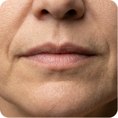 A close-up of a person's mouth and nose, showing wrinkles and skin texture around the lips.