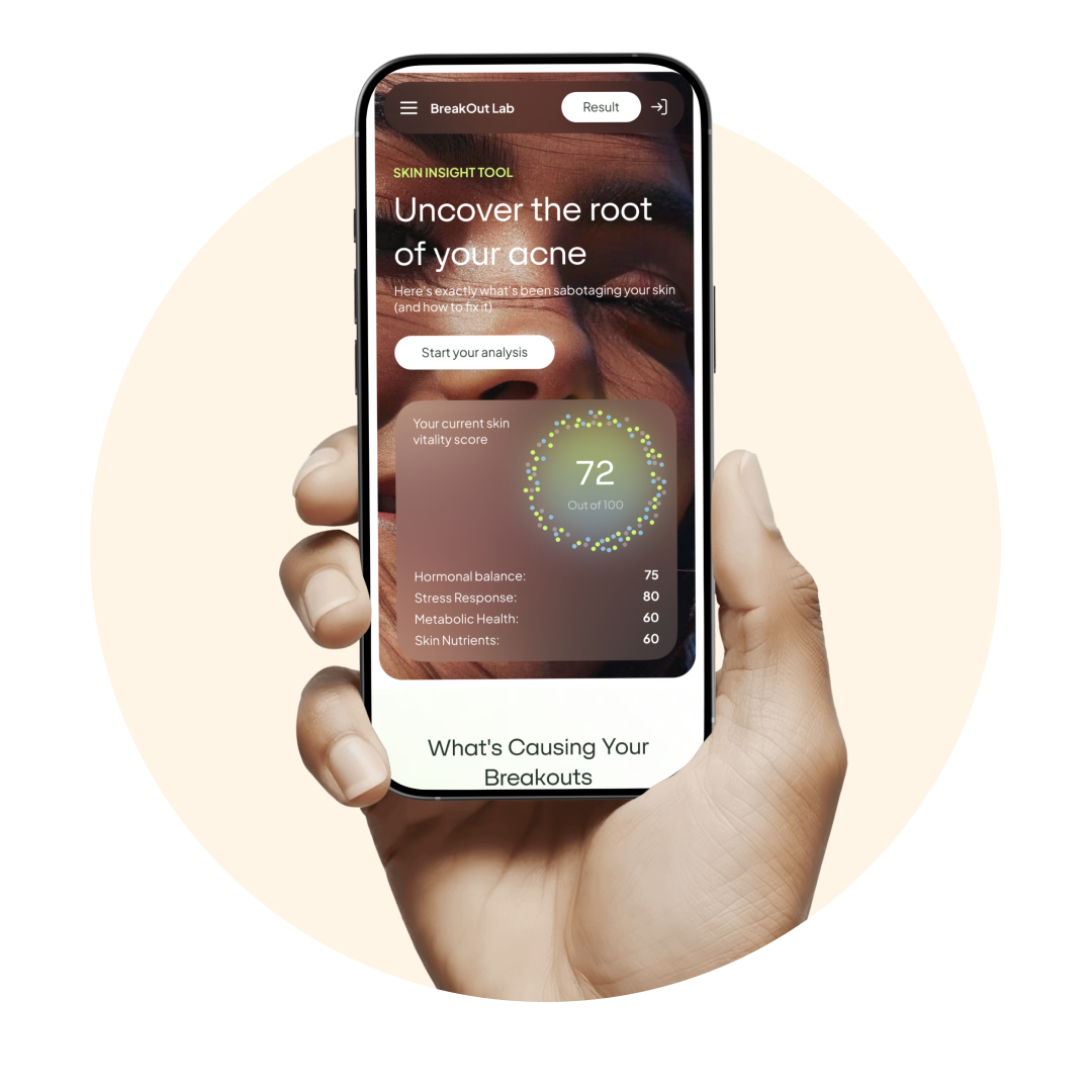 Hand holding smartphone with acne analysis app displaying skin vitality score.