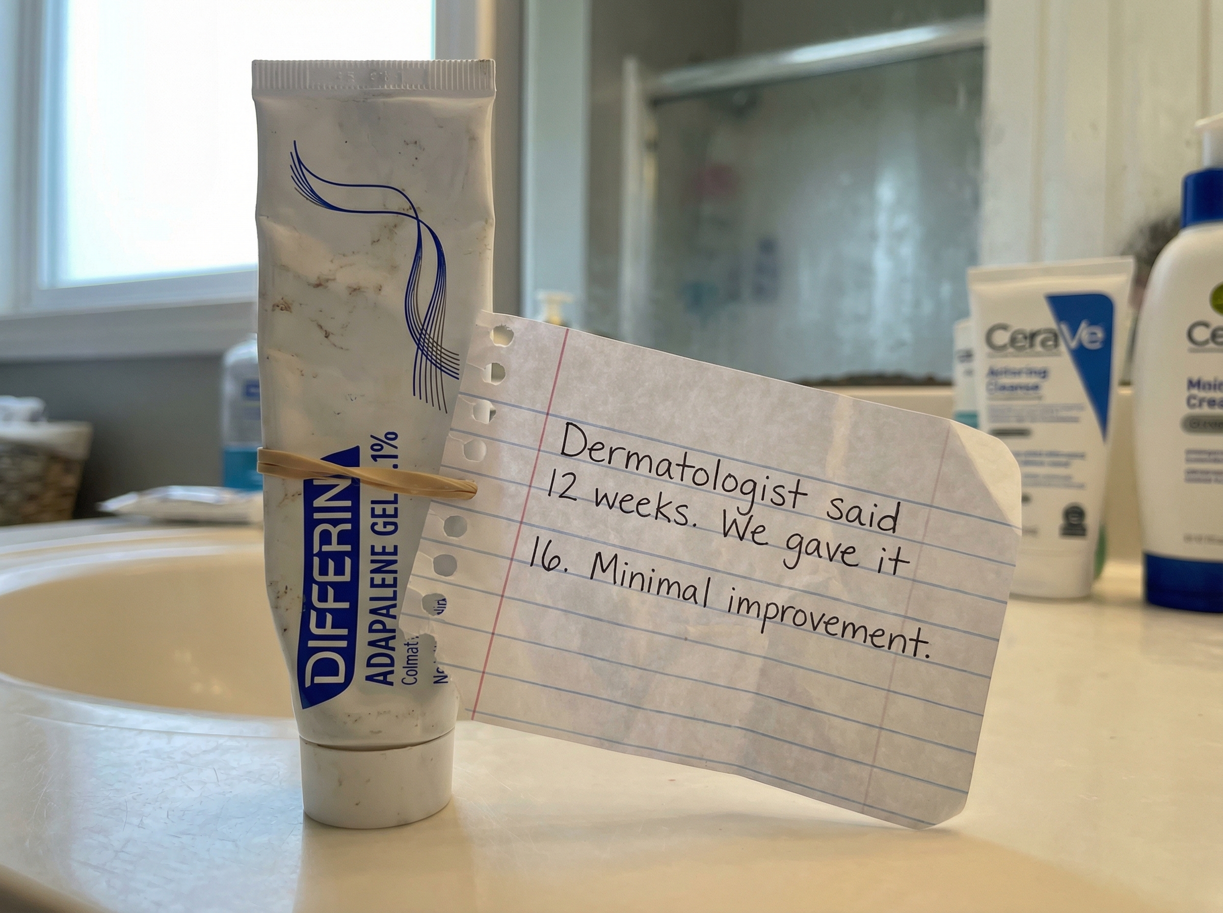 A tube of Differin gel on a bathroom counter with a handwritten note attached by a rubber band.