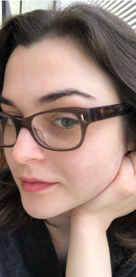 A close-up of a young woman with brown hair and tortoiseshell glasses, resting her chin on her hand.