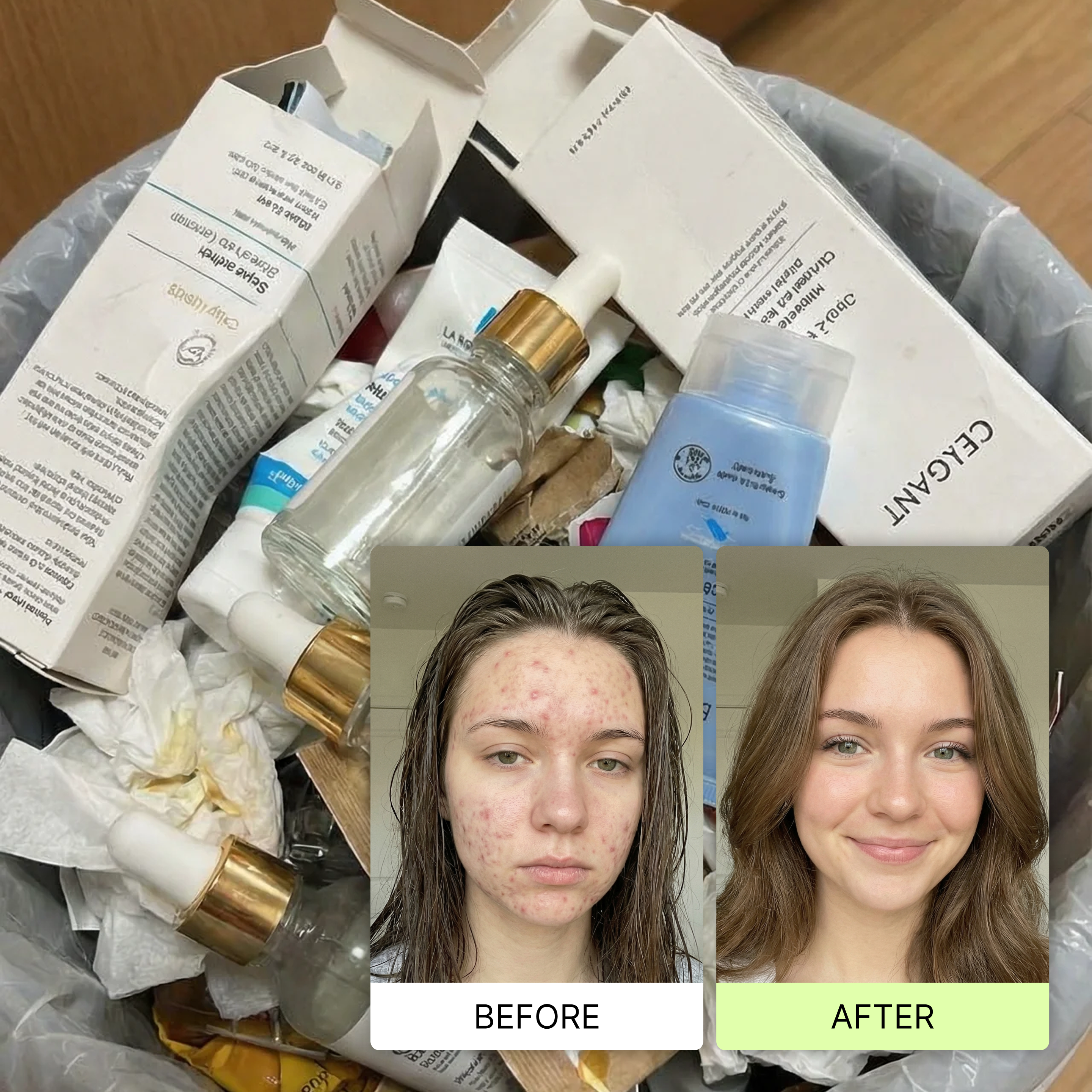 A before and after photo showing a woman's acne improvement, placed over a trash bin of empty cosmetics.