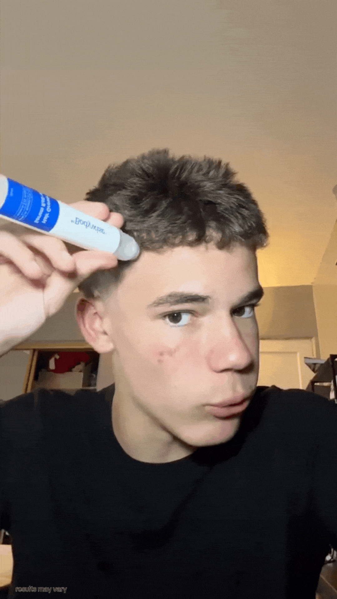 Person applying a product to their forehead with a tube.