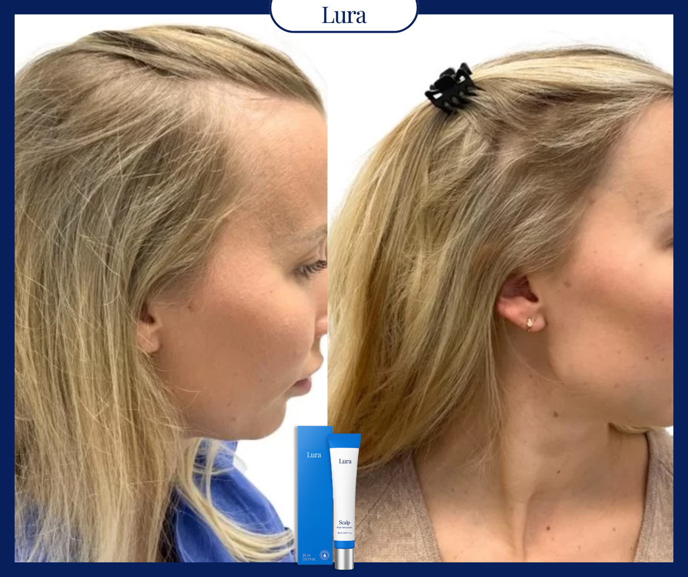 Side-by-side comparison of a woman's hair before and after using a product.