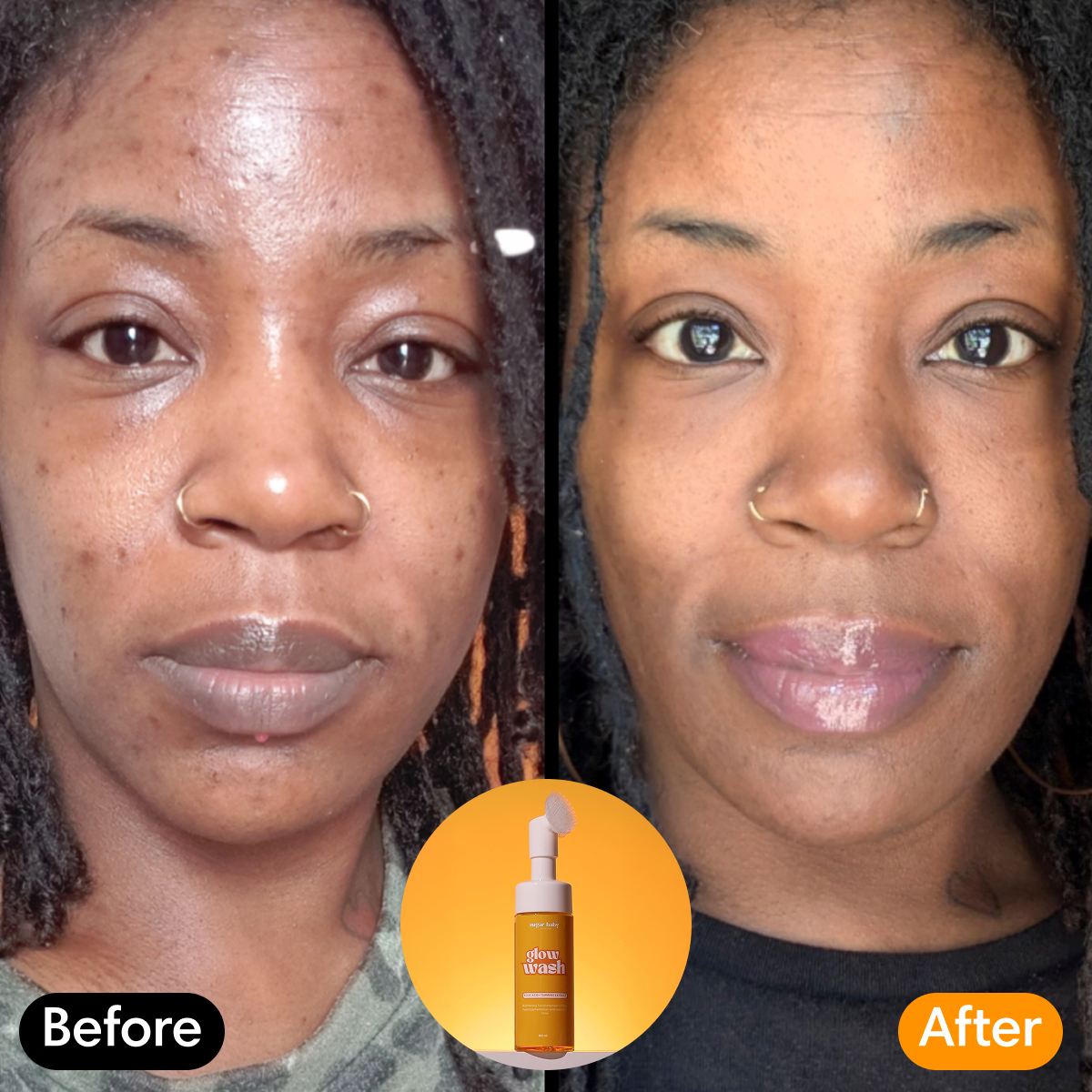 Side-by-side comparison of a woman's face before and after using a skincare product.