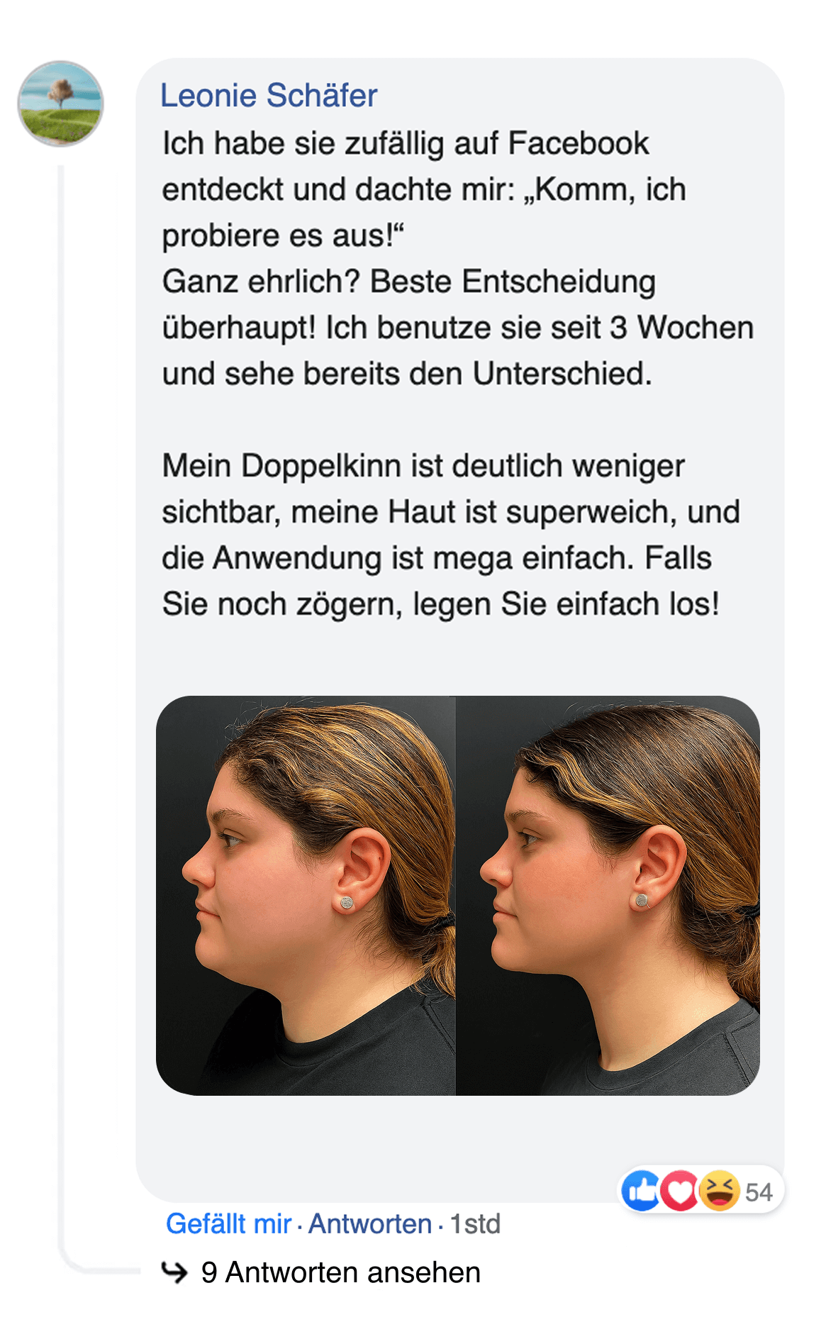 Side-by-side profile photos of a person's face, with German text above.