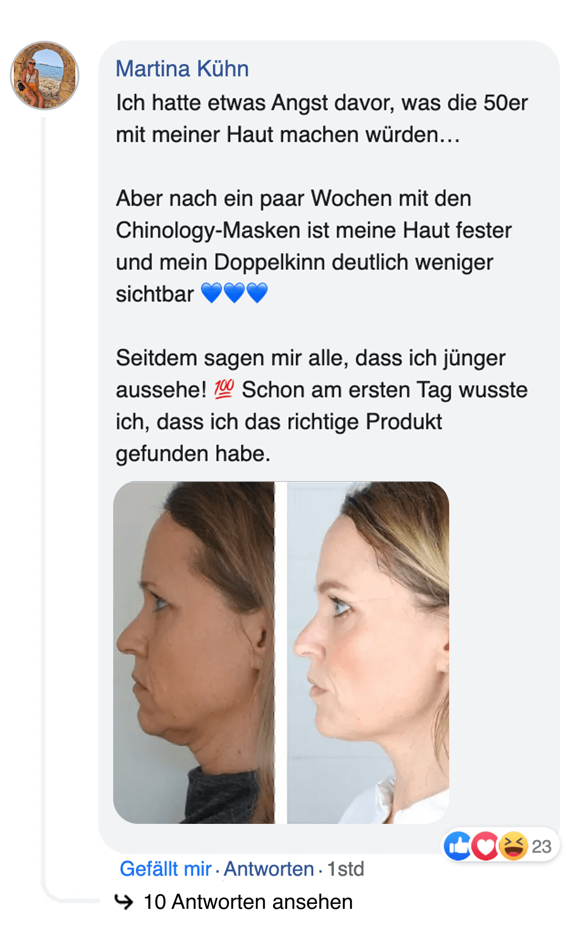 A Facebook post with text and a side-by-side comparison of a woman's profile.