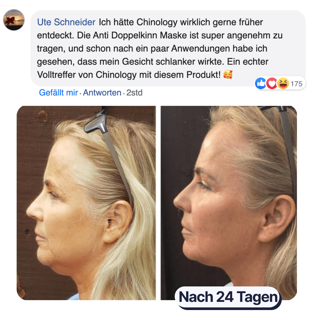 Side-by-side profile photos of a woman before and after 24 days.
