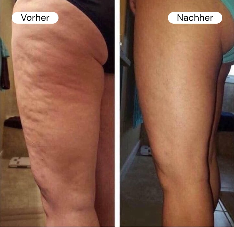 Side-by-side comparison of a leg before and after treatment.