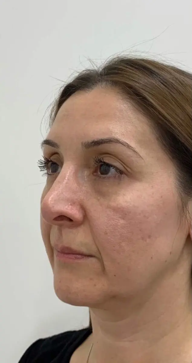 Close-up of a person looking to the side against a plain background.