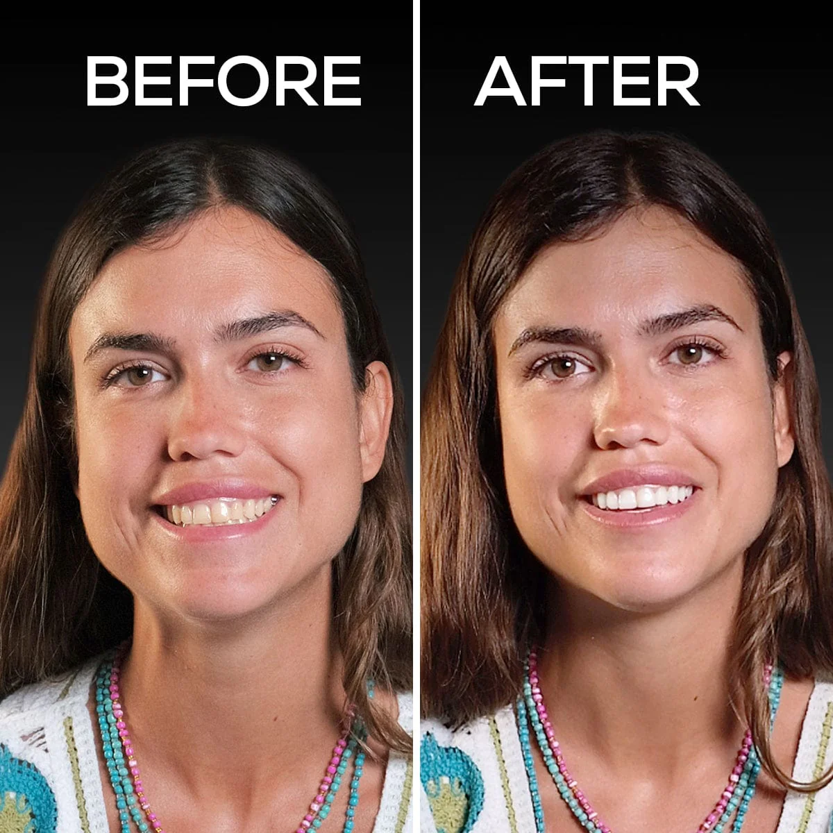 Side-by-side comparison of a woman's face labeled 'Before' and 'After.'