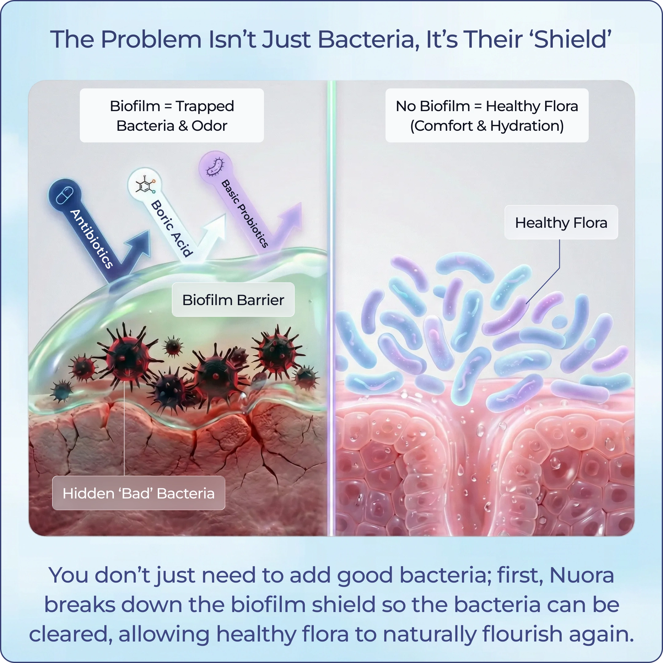 Diagram comparing bad bacteria under a biofilm shield to healthy flora on unprotected tissue.