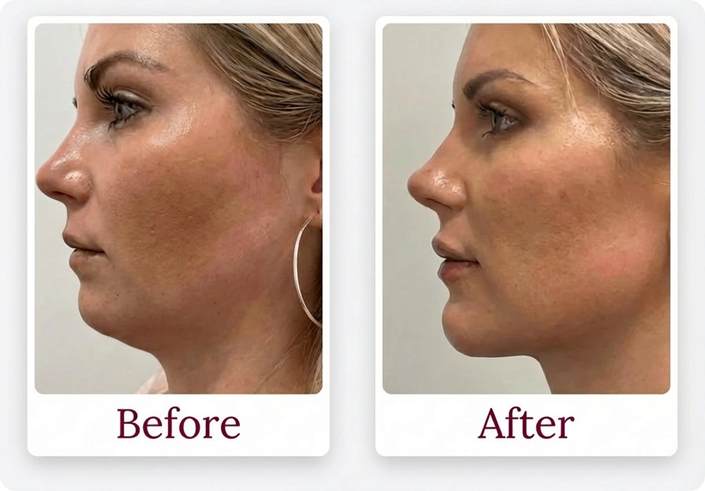 Side-by-side profile photos labeled 'Before' and 'After' showing changes.