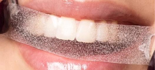 Whitening Strips