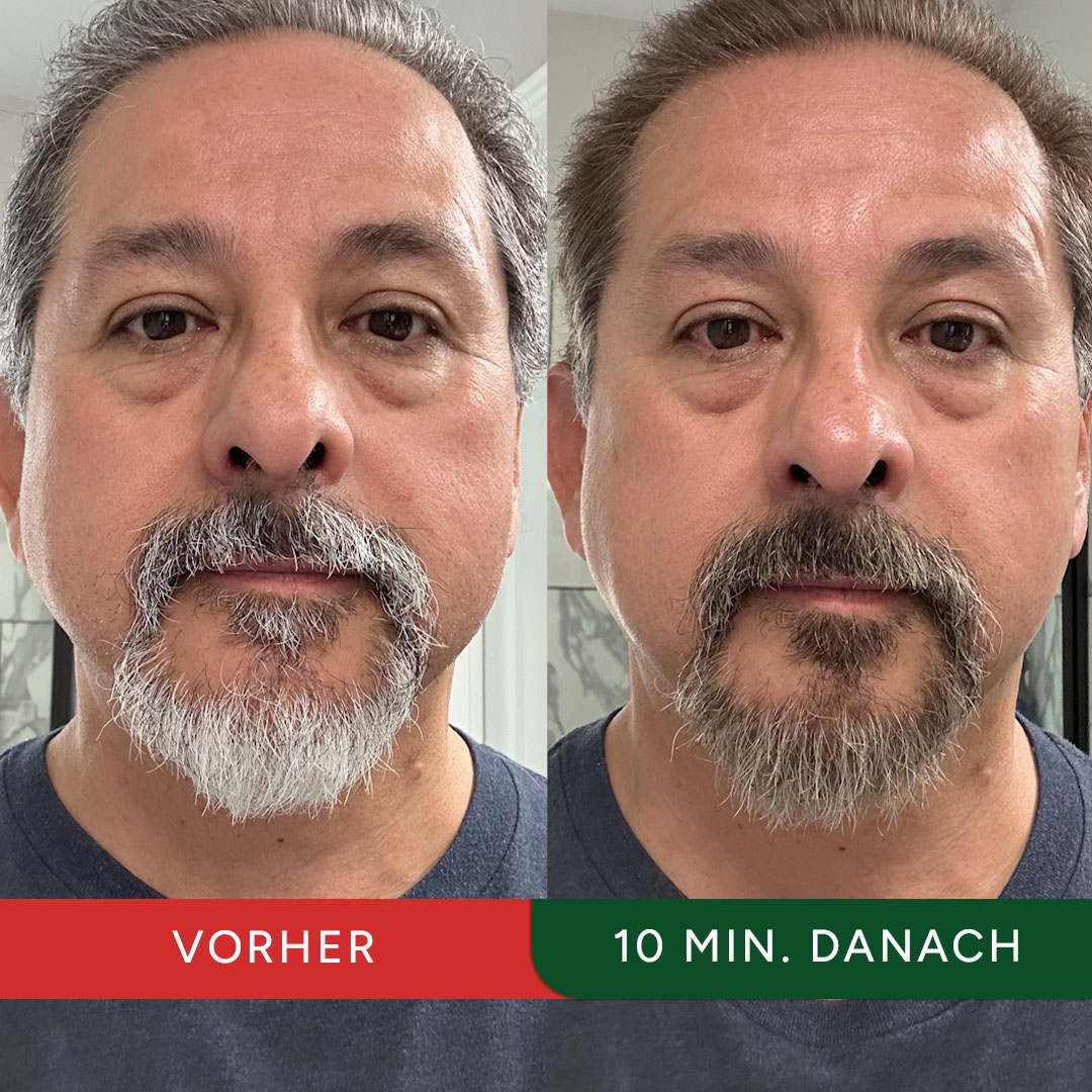 Side-by-side comparison of a man's face before and after 10 minutes.
