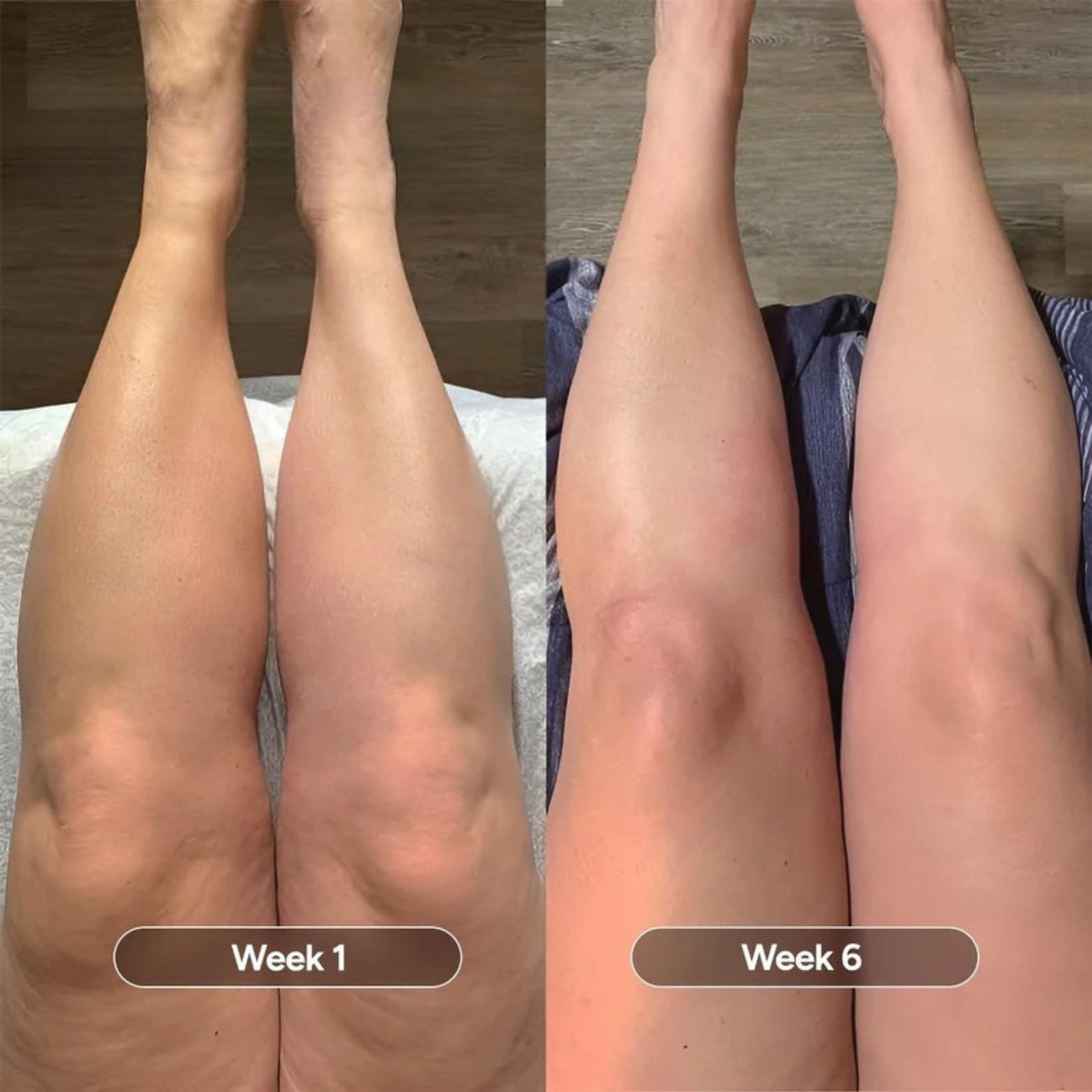 Comparison of legs over six weeks showing changes in appearance.