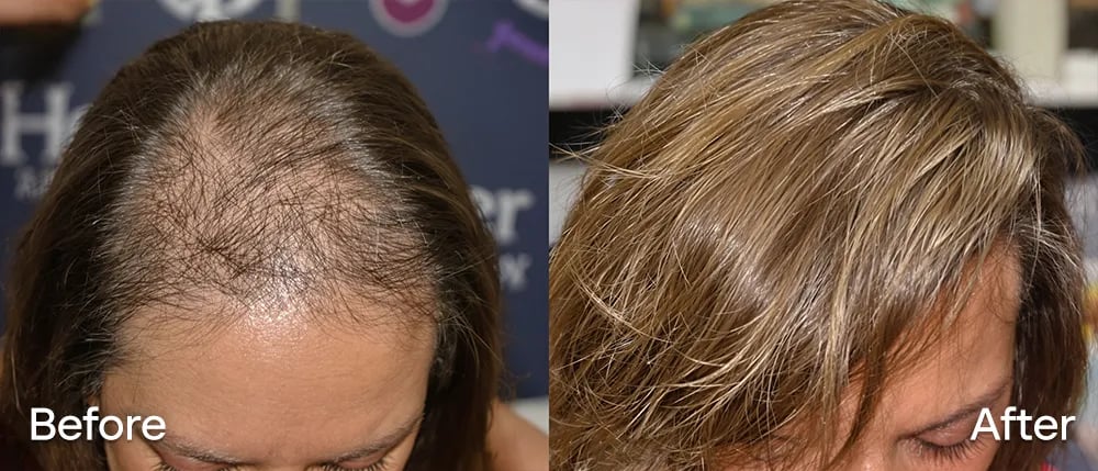 Antes y después de Rachel