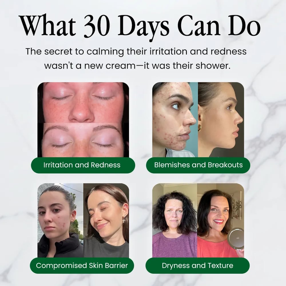 What 30 days can do: customer skin results for redness, breakouts, skin barrier and dryness