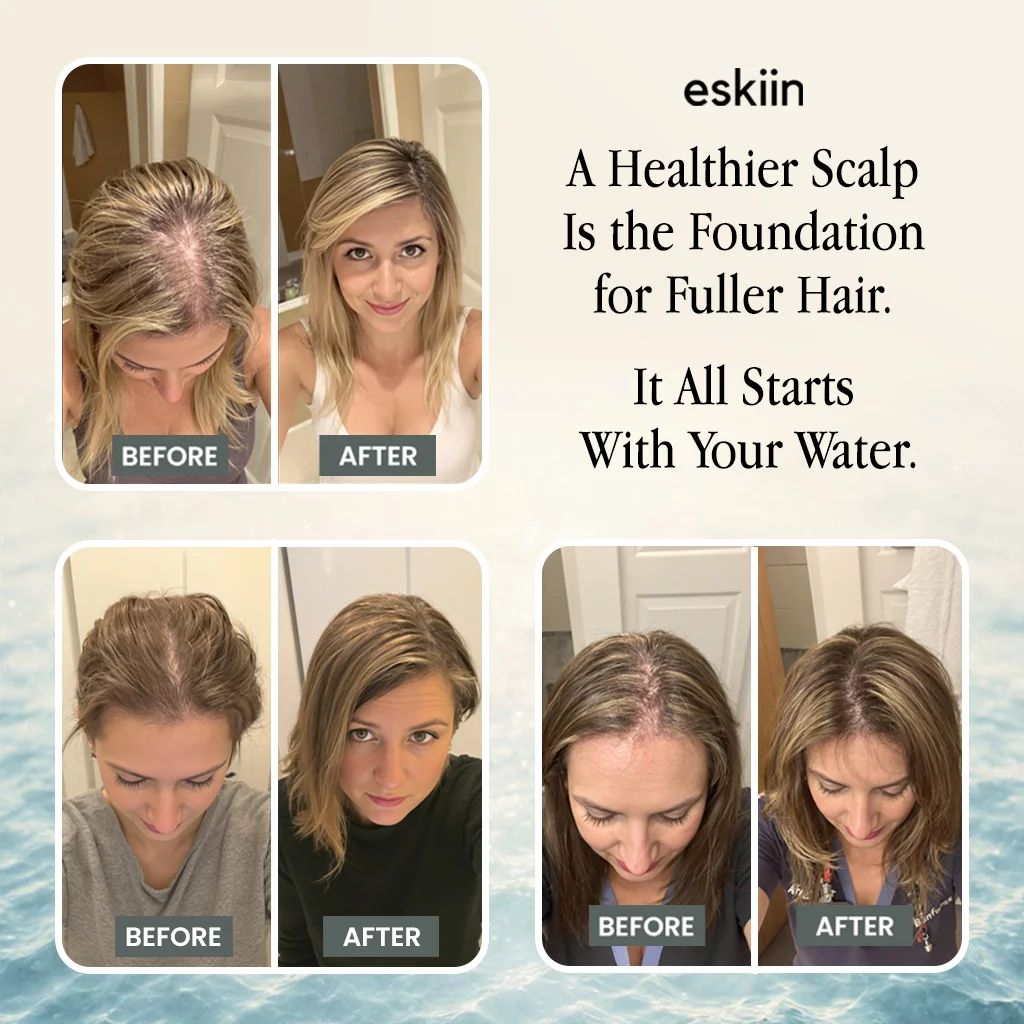 Before and after hair treatment photos with text about scalp health and water.