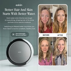 Wall mount showerhead with skin before-and-after comparison photos