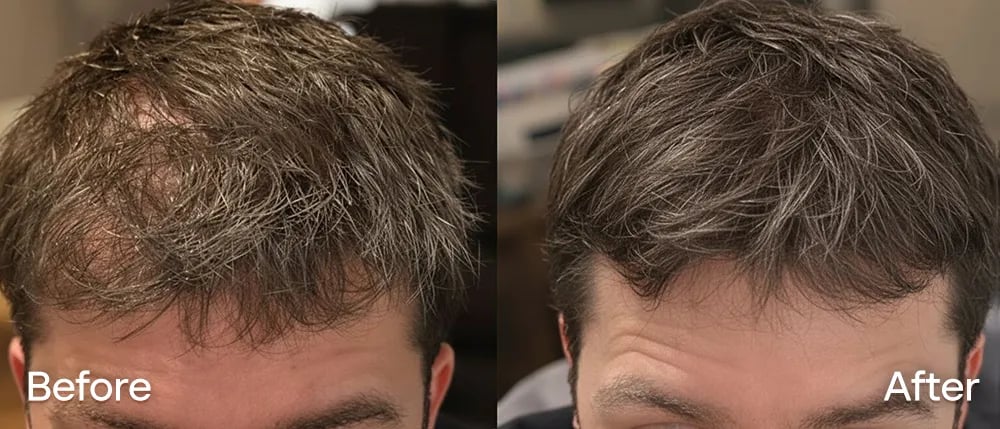 Comparación de cabello antes y después