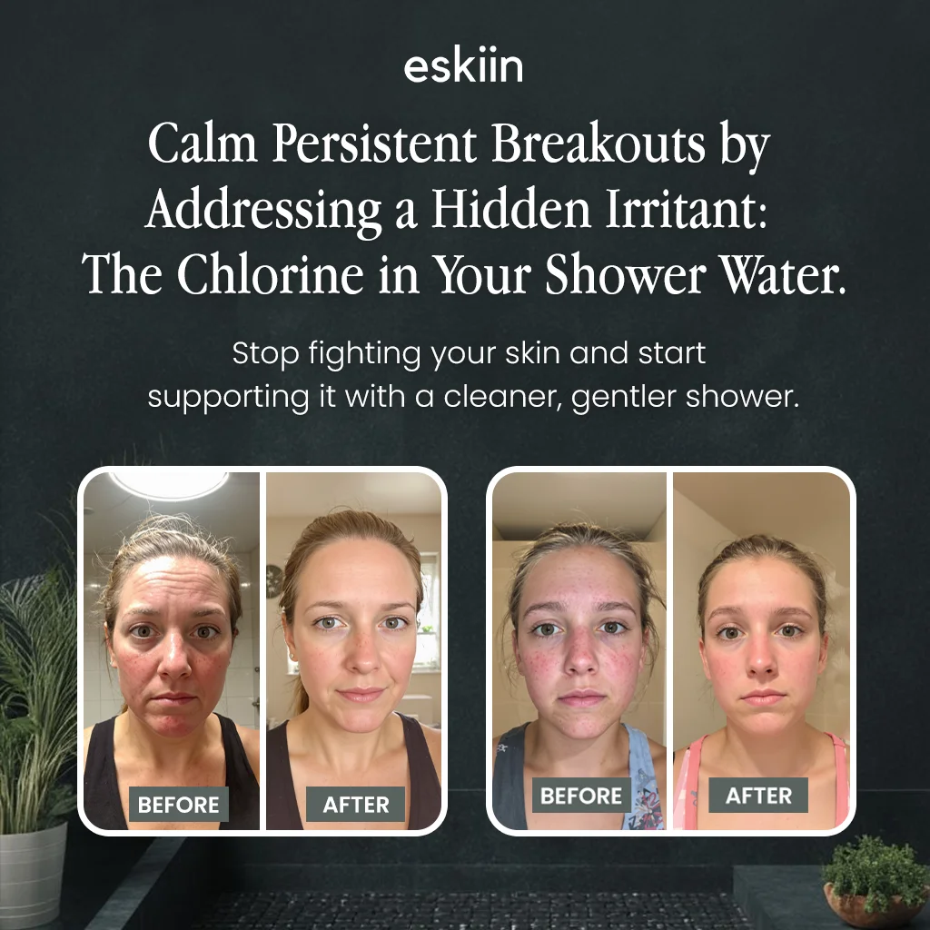 Advertisement showing before and after images of two women with improved skin.