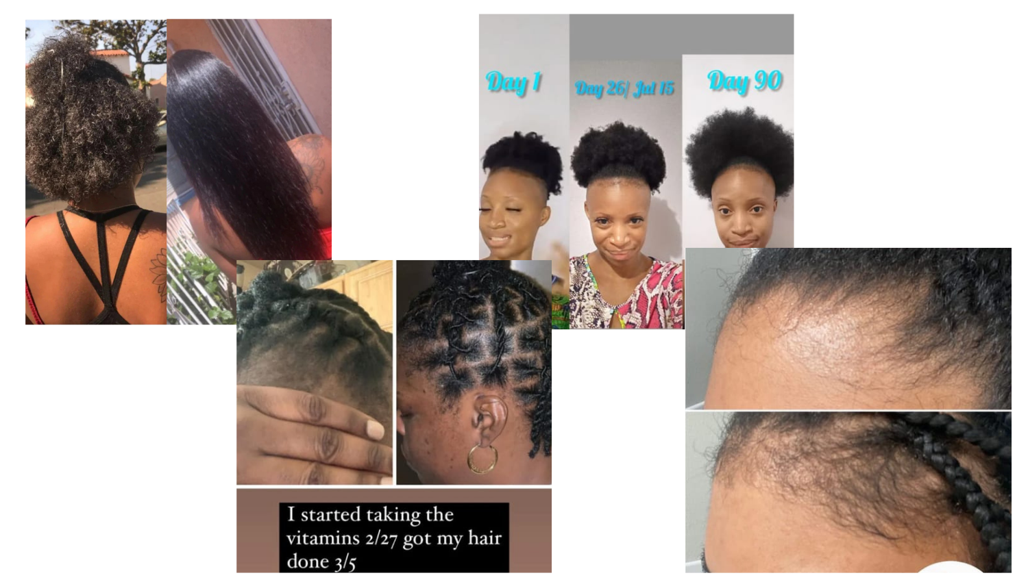 Collage showing hair transformations and hair growth progress.