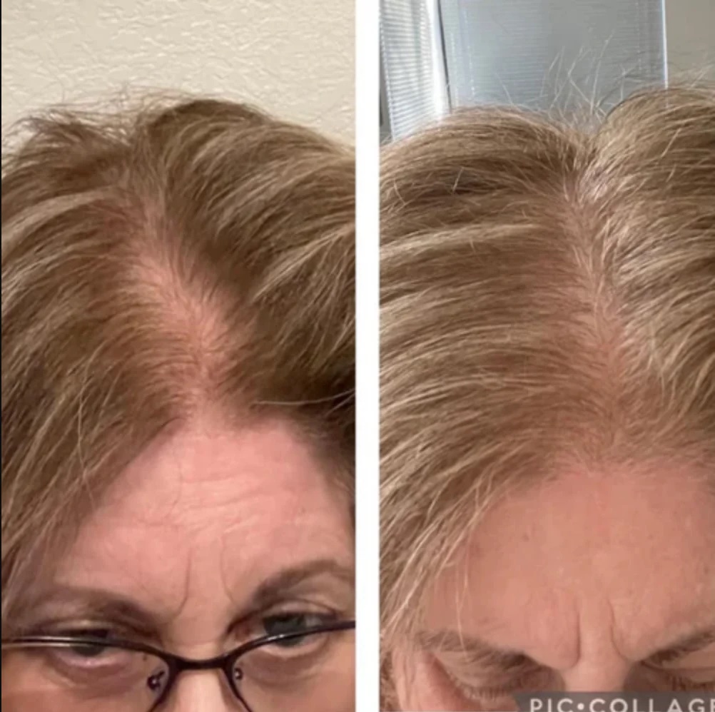 Two side-by-side close-ups of a woman's hair, showing differences in thickness.