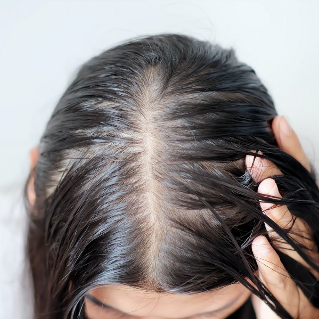 Close-up of a person examining their scalp and hair with hands.