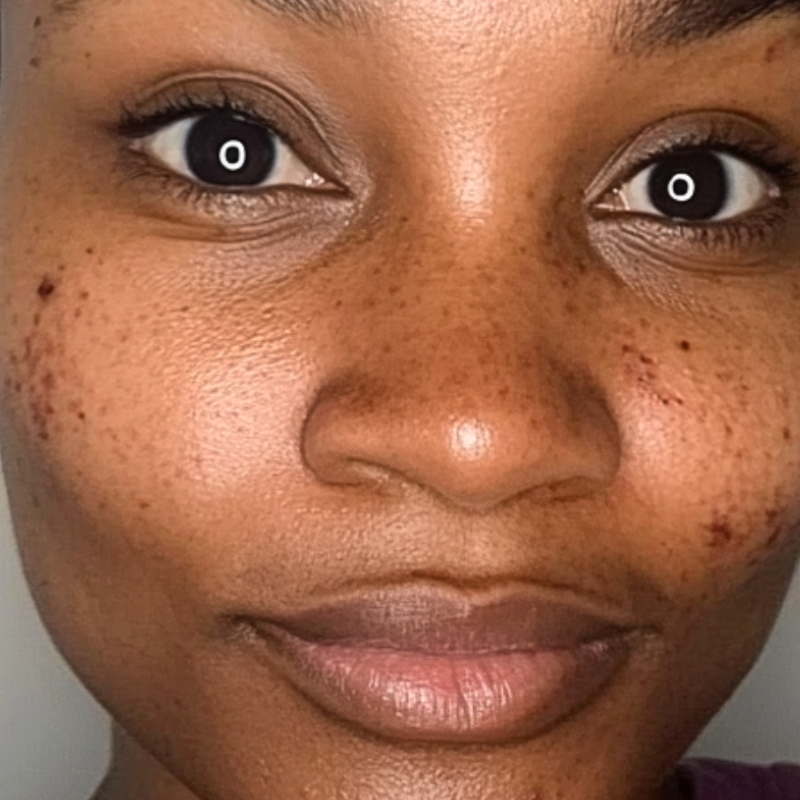Close-up of a person's face with freckles and a neutral expression.