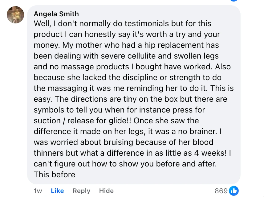 A text testimonial about a product's effectiveness for swelling and cellulite after hip replacement.