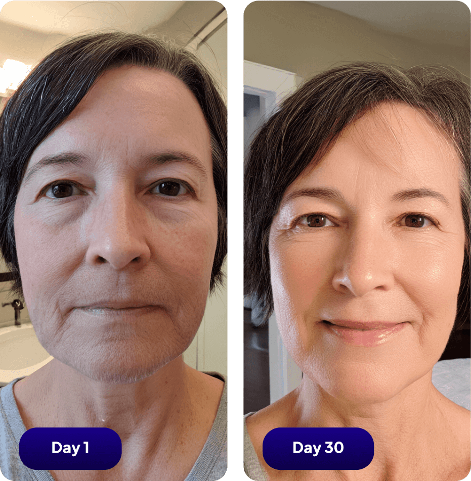 Two side-by-side close-up photos of a person on Day 1 and Day 30.