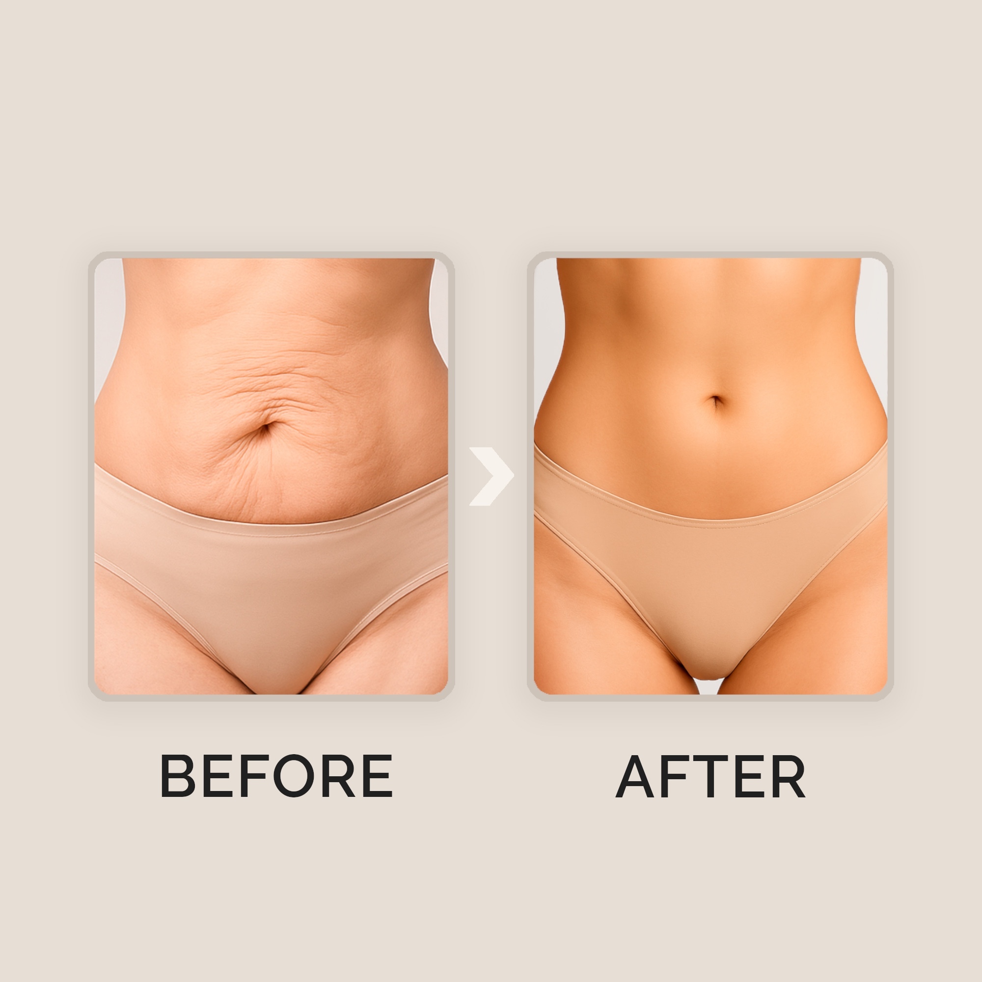 Before and after comparison of a woman's abdomen.
