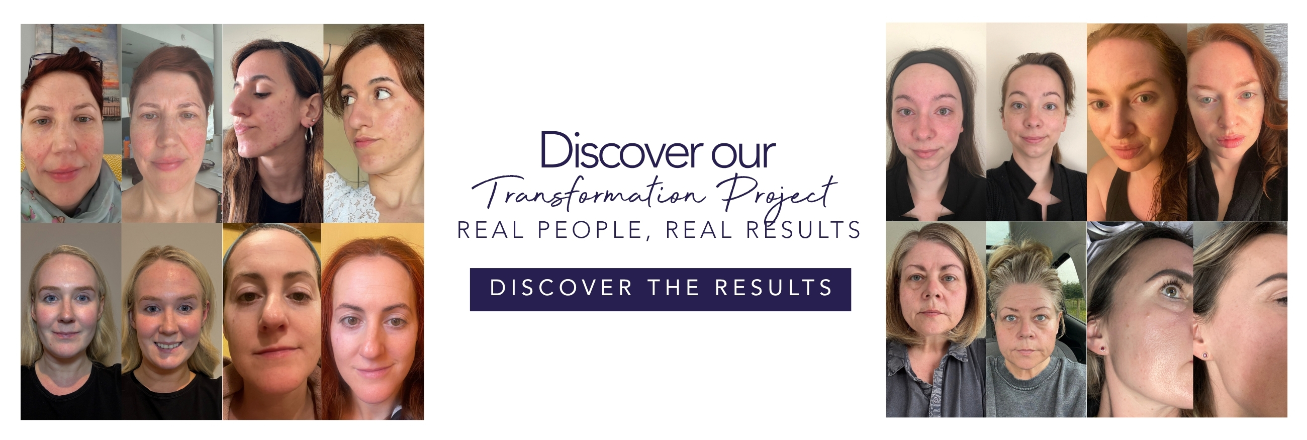 Collage of women's faces with text: 'Discover our Transformation Project, Real People, Real Results.'
