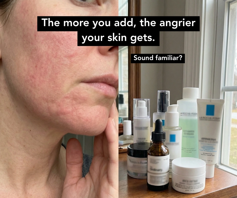 A split image showing a woman's red, irritated facial skin next to a collection of skincare products.