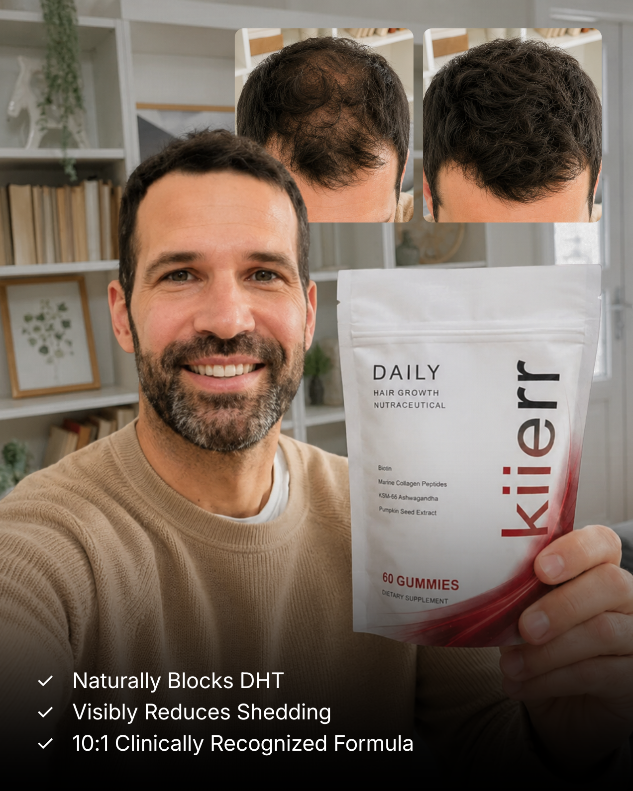 A man holds a pouch of hair growth gummies, with before and after photos of hair regrowth above him.