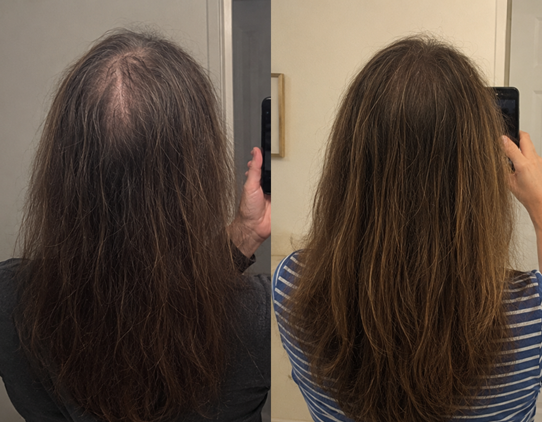 A before-and-after comparison of a woman's hair, showing thinning hair on the left and fuller hair on the right.