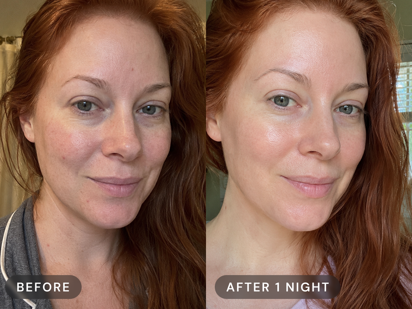 A before and after image showing a woman's face with improved skin appearance after one night.