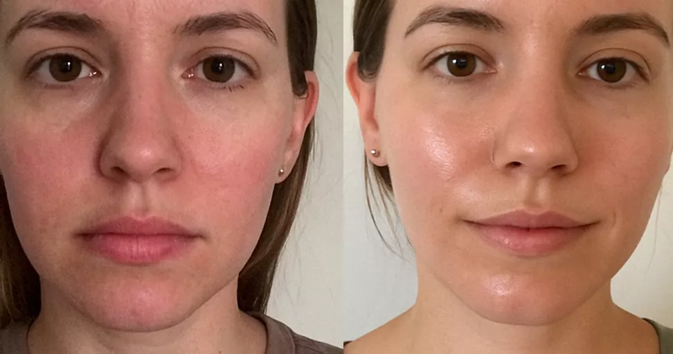 Side-by-side comparison of a woman's face, showing skin differences.