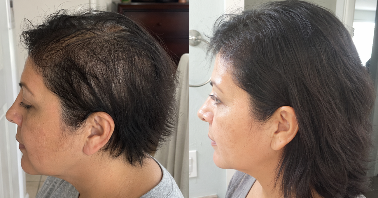 A before and after image showing a woman's hair looking thicker and fuller on the right.