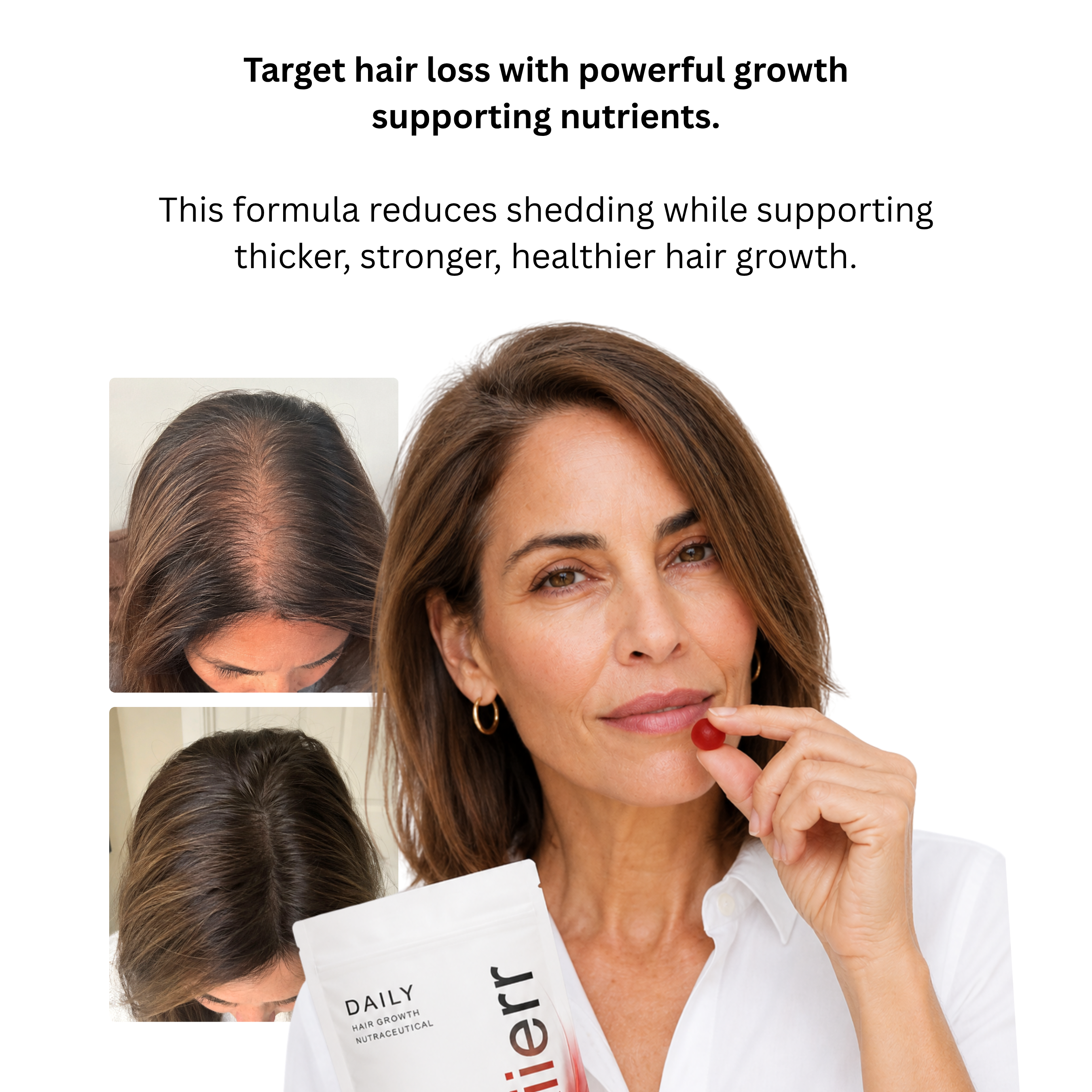 A woman holding a hair supplement gummy, with before and after photos showing hair growth.