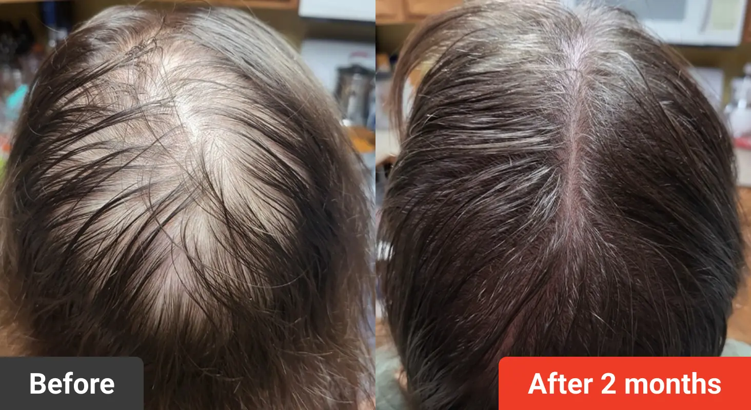 Side-by-side comparison of hair before and after two months of treatment.