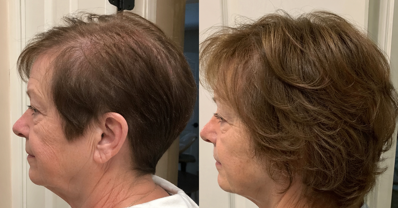 A before-and-after image showing a woman's hair from the side, appearing thicker and fuller in the second photo.