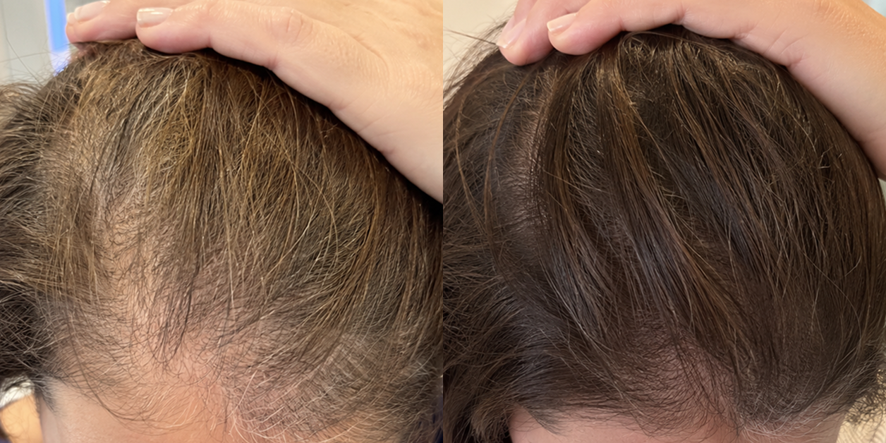 A side-by-side comparison showing thinning hair on the left and thicker, darker hair on the right.